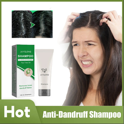 Anti Dandruff Shampoo Seborrheic Anti-Itching Treatment Oil Control Scalp Cleansing Strengthen Hair Roots Smoothing Hair Shampoo