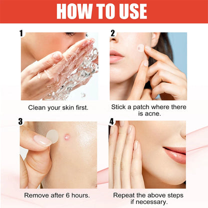 144pcs/set Face Skin Care Acne Pimple Patch 2 Sizes Invisible Professional Healing Absorbing Spot Sticker Covering for Men Women