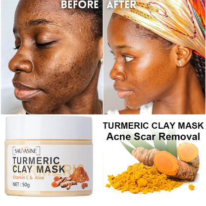 Turmeric Vitamin C Face Mask Acne Dark Spots Removal Exfoliating Oil Control Deep Cleansing Clay Mask Glowing Skin Care Product