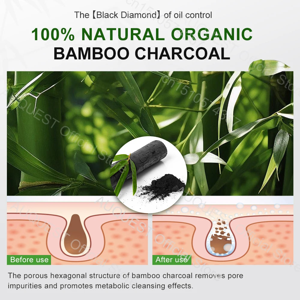 AUQUEST Bamboo Charcoal Face Serum Oil Control Blackheads Remover Brightening Hyaluronic Acid Facial Serum Skin Care