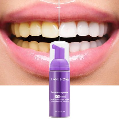 V34 Teeth Mousse Removes Smoke Stains Removes Yellowing and Freshens Breath Effectively Whitens and Removes Yellowing Oral Care