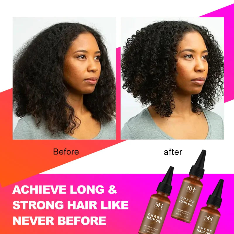 Sevich Hair Growth Products for Women Africa Traction Alopecia Chebe Hair Growing Oil Anti Hair Loss Treatment Thicken Hair Care