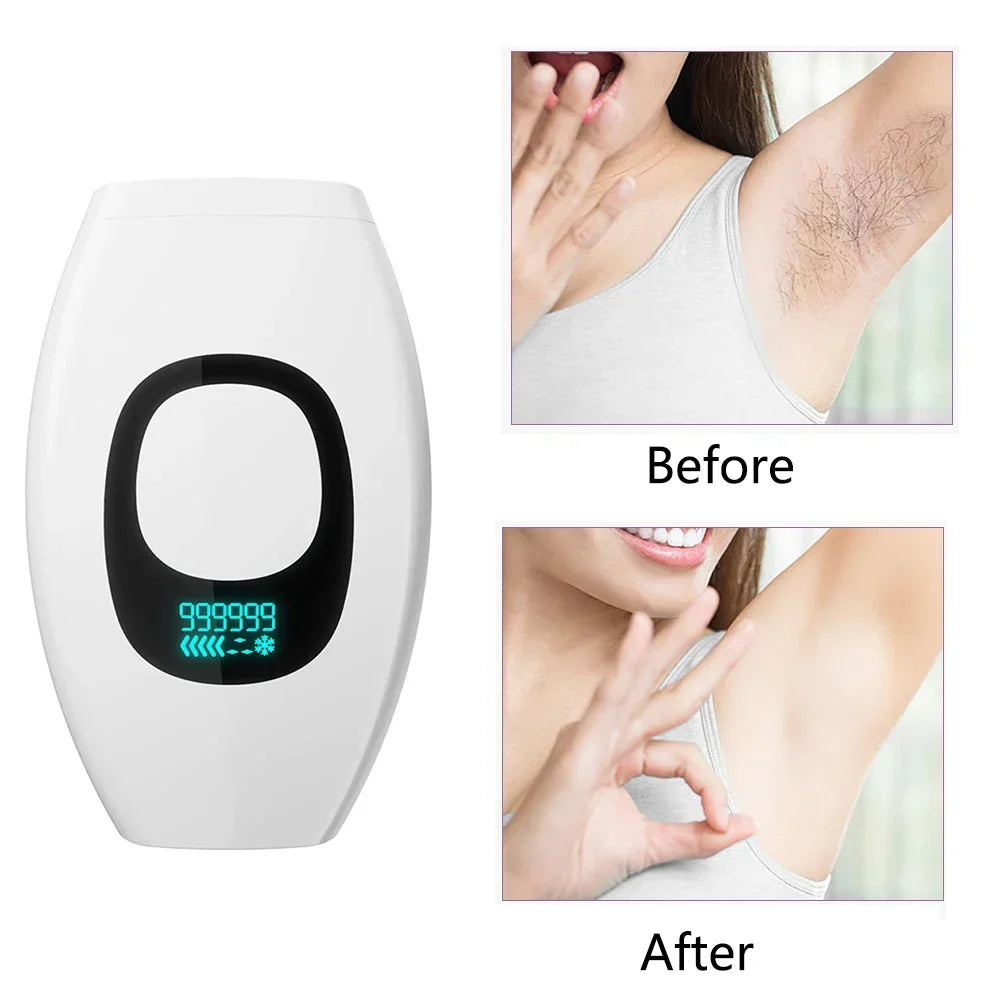 Handheld Laser Hair Removal 999999 Flashes Painless High-frequency Female Permanent Epilator Electric Depilador Laser