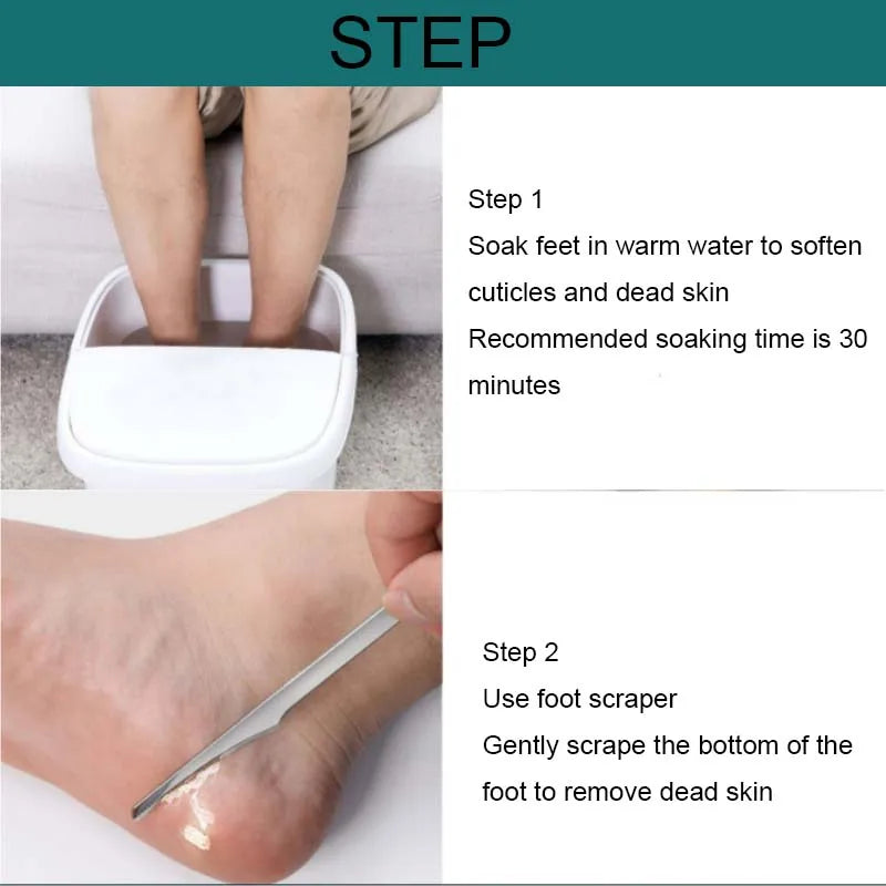 Manicure Pedicure Tools Toe Nail Shaver Feet Pedicure Knife Kit Foot Callus Rasp File Dead Skin Remover Foot Care Tools