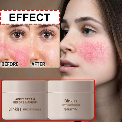 Facial Redness Repair Cream Improve Sensitive Skin Dryness Moisturizer Hydrating Sooth Lotion Removal Rosacea Korean Cosmetics